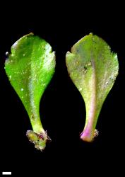 Veronica zygantha. Leaf surfaces, adaxial (left) and abaxial (right). Scale = 1 mm.
 Image: P.J. Garnock-Jones © Te Papa CC-BY-NC 3.0 NZ